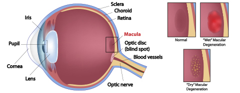 Best Retina Specialist in Kerala