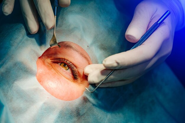 Why Femtocataract Surgery Is Safer, Smarter, and More Precise Than Traditional Cataract Surgery
