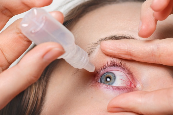 DRY EYES: CAUSES, SYMPTOMS, AND EFFECTIVE RELIEF OPTIONS